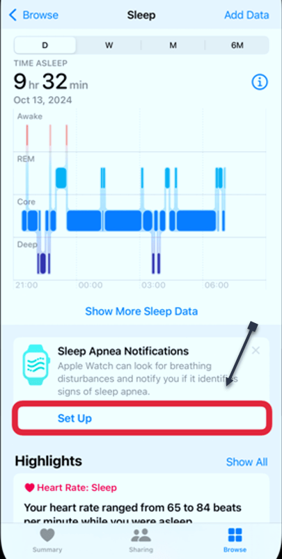 Sleep Apnea 4